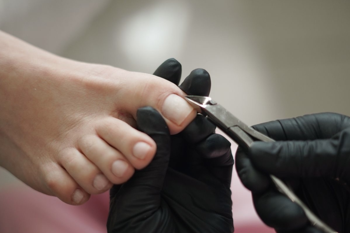 Ingrown  Image 2
